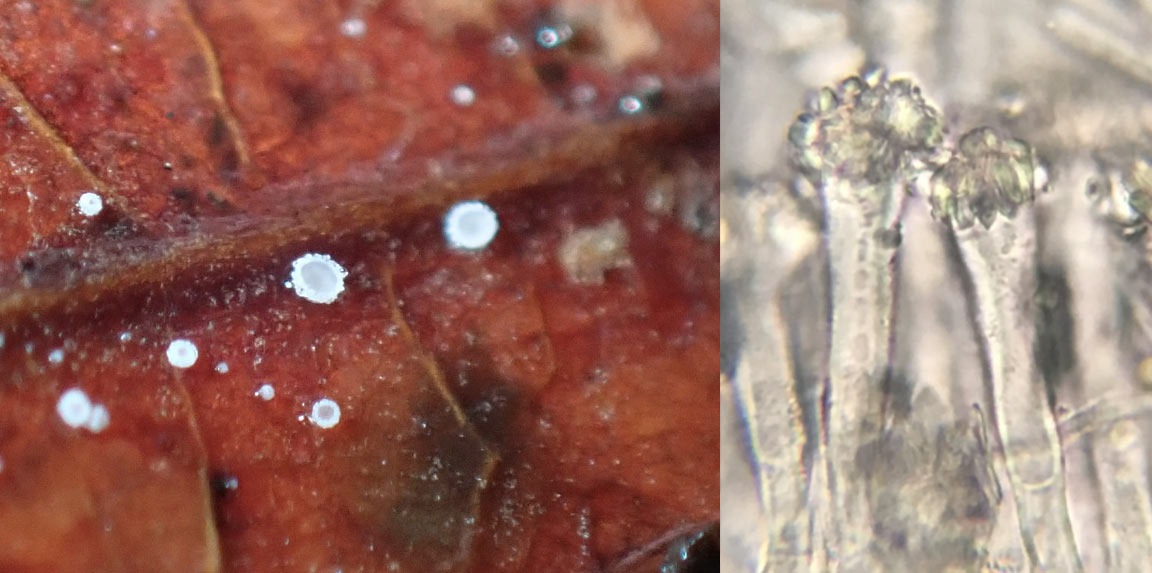 Incrucipulum capitatum; Prospect Park; May 25, 2026; Morgan Yacullo, microscopy, Ethan Crenson